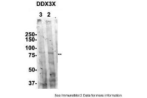 Sample Type: 1. (DDX3X Antikörper  (N-Term))