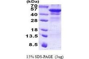 Figure annotation denotes ug of protein loaded and % gel used. (Hexosaminidase A Protein (HEXA))