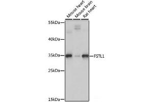 Western blot analysis of extracts of various cell lines using FSTL1 Polyclonal Antibody at dilution of 1:1000. (FSTL1 Antikörper)
