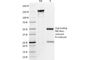 SDS-PAGE Analysis Purified CD86 Mouse Monoclonal Antibody (BU63). (CD86 Antikörper)