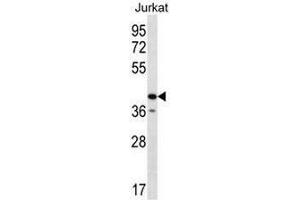 Western Blotting (WB) image for anti-Golgi Reassembly Stacking Protein 2, 55kDa (GORASP2) (AA 184-214), (Middle Region) antibody (ABIN952579)