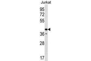 GORASP2 Antibody (Center) western blot analysis in Jurkat cell line lysates (35µg/lane). (GORASP2 Antikörper  (Middle Region))
