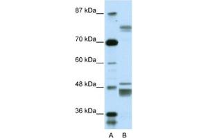 Western Blotting (WB) image for anti-Zinc Finger Protein 607 (ZNF607) antibody (ABIN2461282) (ZNF607 Antikörper)