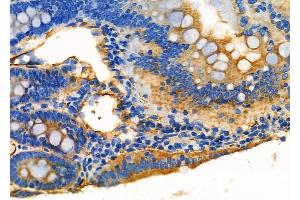 ABIN6266210 and ABIN6277363 at 1/100 staining Rat colorectal tissue by IHC-P. (ENPP7 Antikörper  (Internal Region))