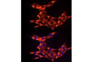 Immunofluorescence analysis of NIH/3T3 cells using RPL10A Rabbit mAb (ABIN7269992) at dilution of 1:100 (40x lens).