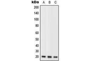 Western blot analysis of RPL11 expression in Jurkat (A), mouse liver (B), H9C2 (C) whole cell lysates.