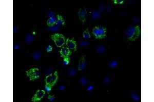 Anti-ACO2 mouse monoclonal antibody (ABIN2452696) immunofluorescent staining of COS7 cells transiently transfected by pCMV6-ENTRY ACO2 (RC204307). (ACO2 Antikörper)