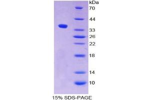 SDS-PAGE analysis of Human ALPPL2 Protein. (ALPPL2 Protein)