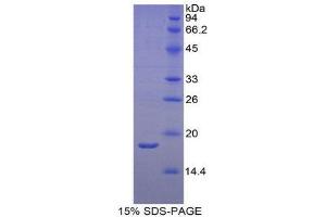 SDS-PAGE (SDS) image for Retinol Binding Protein 2, Cellular (RBP2) (AA 1-134) protein (His tag) (ABIN1821587)