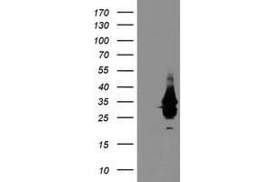 Western Blotting (WB) image for anti-Single-Stranded DNA Binding Protein 1 (SSBP1) antibody (ABIN1499909) (SSBP1 Antikörper)