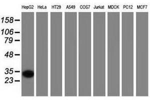 Image no. 2 for anti-Sulfotransferase Family, Cytosolic, 2A, Dehydroepiandrosterone (DHEA)-Preferring, Member 1 (SULT2A1) antibody (ABIN1501238) (SULT2A1 Antikörper)