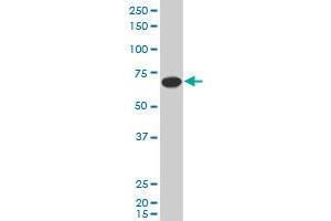 Western Blotting (WB) image for anti-Solute Carrier Family 27 (Fatty Acid Transporter), Member 5 (SLC27A5) (AA 90-175) antibody (ABIN564767)