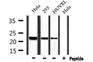 Western blot analysis of extracts from Hela,293 and HUVEC, using FTH1 Antibody. (FTH1 Antikörper  (C-Term))