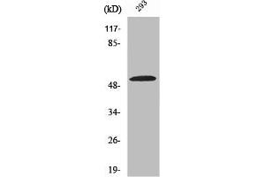 Western Blot analysis of COLO205 cells using ZIP7 Polyclonal Antibody (SLC39A7 Antikörper  (Internal Region))