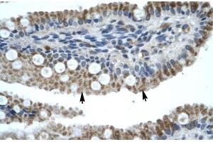 Human Intestine (ZNF683 Antikörper  (N-Term))