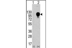 Western blot analysis of LP2 (arrow) using LP2 Antibody (Center) (ABIN388569 and ABIN2849749). (LAMP2 Antikörper  (AA 196-225))