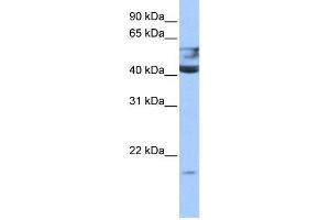 WB Suggested Anti-QTRT1 Antibody Titration:  0. (QTRT1 Antikörper  (N-Term))