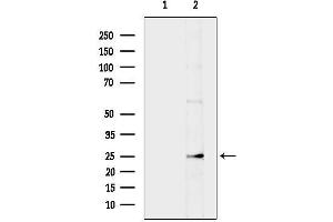 anti-BCL2-Antagonist/killer 1 (BAK1) (N-Term) antibody