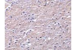 Immunohistochemistry of Clusterin in human brain tissue with Clusterin antibody at 10 μg/ml. (Clusterin Antikörper  (Isoform 1))
