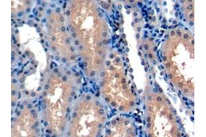 Detection of HIF1a in Human Cardiac Muscle Tissue using Polyclonal Antibody to Hypoxia Inducible Factor 1 Alpha (HIF1a) (HIF1A Antikörper  (AA 575-826))