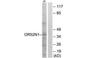 Western blot analysis of extracts from Jurkat cells, using OR52N1 Antibody. (OR52N1 Antikörper  (AA 269-318))