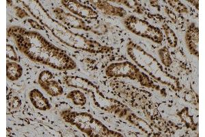 ABIN6278352 at 1/100 staining Human kidney tissue by IHC-P. (ARL4A Antikörper  (Internal Region))