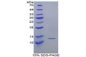 SDS-PAGE (SDS) image for Chemokine (C Motif) Ligand 1 (XCL1) (AA 26-111) protein (His tag,T7 tag) (ABIN1879854)