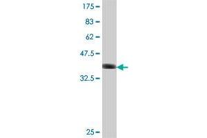 Western Blot detection against Immunogen (37 KDa) . (MAGI1 Antikörper  (AA 761-859))