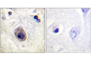 Immunohistochemistry analysis of paraffin-embedded human brain, using Connexin 43 (Phospho-Ser261) Antibody.