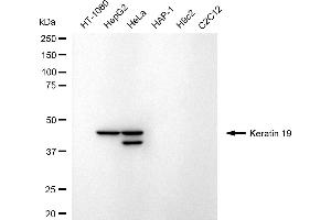 Western blotting analysis using keratin 19 antibody (ABIN7799176).
