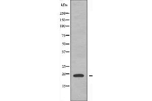 Western blot analysis of extracts from A549 cells, using Histone 1F0 antibody. (Histone H1 Antikörper  (Internal Region))
