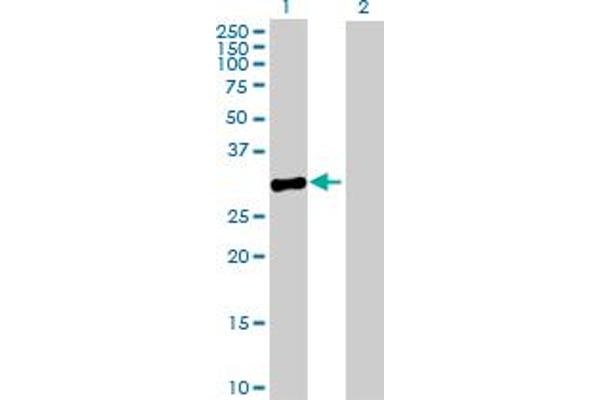 MPPED2 Antikörper  (AA 1-294)