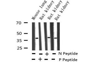 Western blot analysis of Phospho-c-Jun (Tyr170) expression in various lysates (C-JUN Antikörper  (pTyr170))