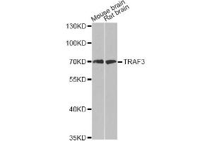 Western blot analysis of extracts of various cell lines, using TRAF3 antibody (ABIN6292132) at 1:500 dilution. (TRAF3 Antikörper)