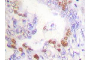 Image no. 1 for anti-Fanconi Anemia, Complementation Group D2 (FANCD2) antibody (ABIN265413) (FANCD2 Antikörper)