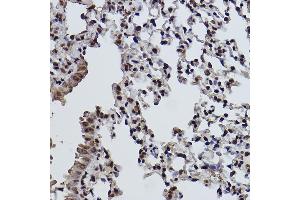 Immunohistochemistry of paraffin-embedded mouse lung using MonoMethyl-Histone H3-K9 antibody (ABIN7267685) at dilution of 1:100 (40x lens).