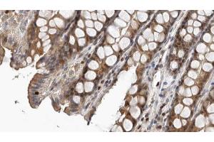 ABIN6267378 at 1/100 staining Rat colon tissue by IHC-P. (NCF1 Antikörper  (pSer359))