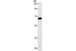 Gel: 10 % SDS-PAGE, Lysate: 40 μg, Lane: Mouse liver tissue, Primary antibody: ABIN7192428(SLC22A3 Antibody) at dilution 1/400, Secondary antibody: Goat anti rabbit IgG at 1/8000 dilution, Exposure time: 1 minute (SLC22A3 Antikörper)
