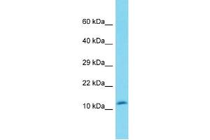 Host: Rabbit Target Name: DEFB119 Sample Type: Fetal Heart lysates Antibody Dilution: 1.
