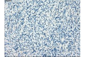 Immunohistochemical staining of paraffin-embedded colon tissue using anti-LTA4H mouse monoclonal antibody. (LTA4H Antikörper)