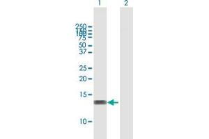 Western Blot analysis of RBBP6 expression in transfected 293T cell line by RBBP6 MaxPab polyclonal antibody.