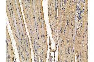 anti-Tetratricopeptide Repeat Domain 21B (TTC21B) antibody