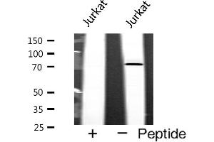 Western blot analysis of p73 expression in Jurkat cells (Tumor Protein p73 Antikörper)