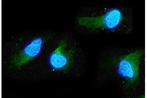 IF analysis of ADO using anti-ADO antibody (ABIN4886431). (ADO Antikörper  (AA 49-261))