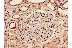 Immunohistochemistry (IHC) image for anti-Bone Morphogenetic Protein 2 (BMP2) (AA 283-396) antibody (ABIN7145684)