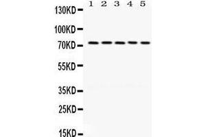 Western Blotting (WB) image for anti-LIM Domain Kinase 1 (LIMK1) (AA 599-634), (C-Term) antibody (ABIN3043411) (LIM Domain Kinase 1 Antikörper  (C-Term))