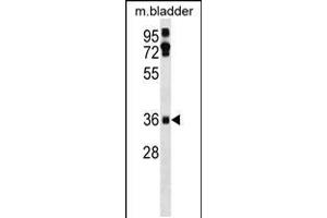 Western blot analysis in mouse bladder tissue lysates (35ug/lane). (EI24 Antikörper  (C-Term))