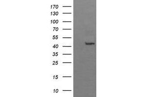 Image no. 1 for anti-butyrobetaine (Gamma), 2-Oxoglutarate Dioxygenase (Gamma-butyrobetaine Hydroxylase) 1 (BBOX1) antibody (ABIN1496816)