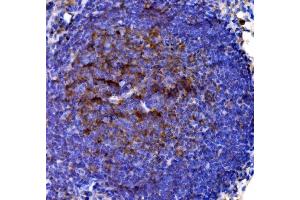 IHC analysis of Cd38 using anti-Cd38 antibody (ABIN7602864).