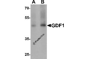 Western Blotting (WB) image for anti-Growth Differentiation Factor 1 (GDF1) (N-Term) antibody (ABIN1077398)